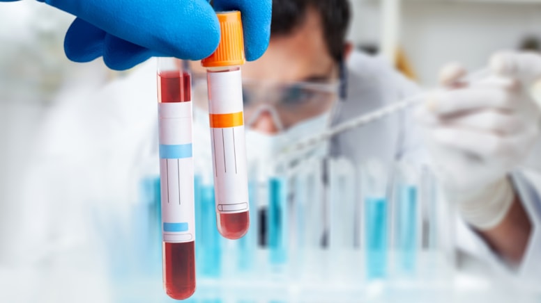 Hatırlamak için yeni umut: Bu test her şeyi değiştirebilir!