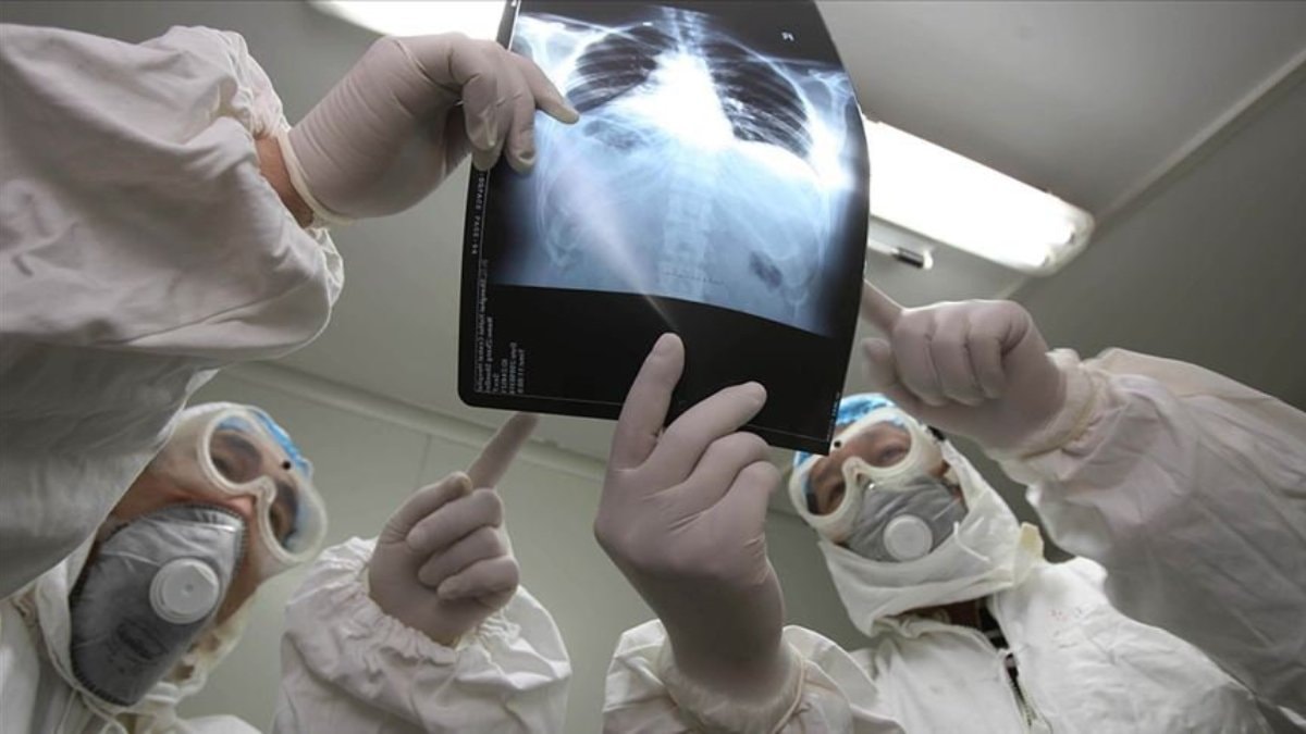 İngiltere’de ilk kez görüldü: Endişelendiren virüs