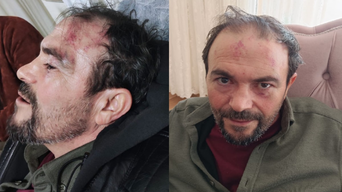 Şaka sanıp polise kimlik göstermedi... Öğretmenden darp iddiası