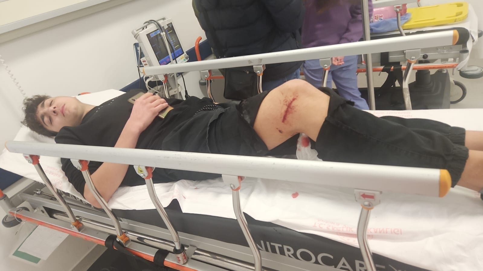 Başıboş köpekler öğrenciyi hastanelik etti