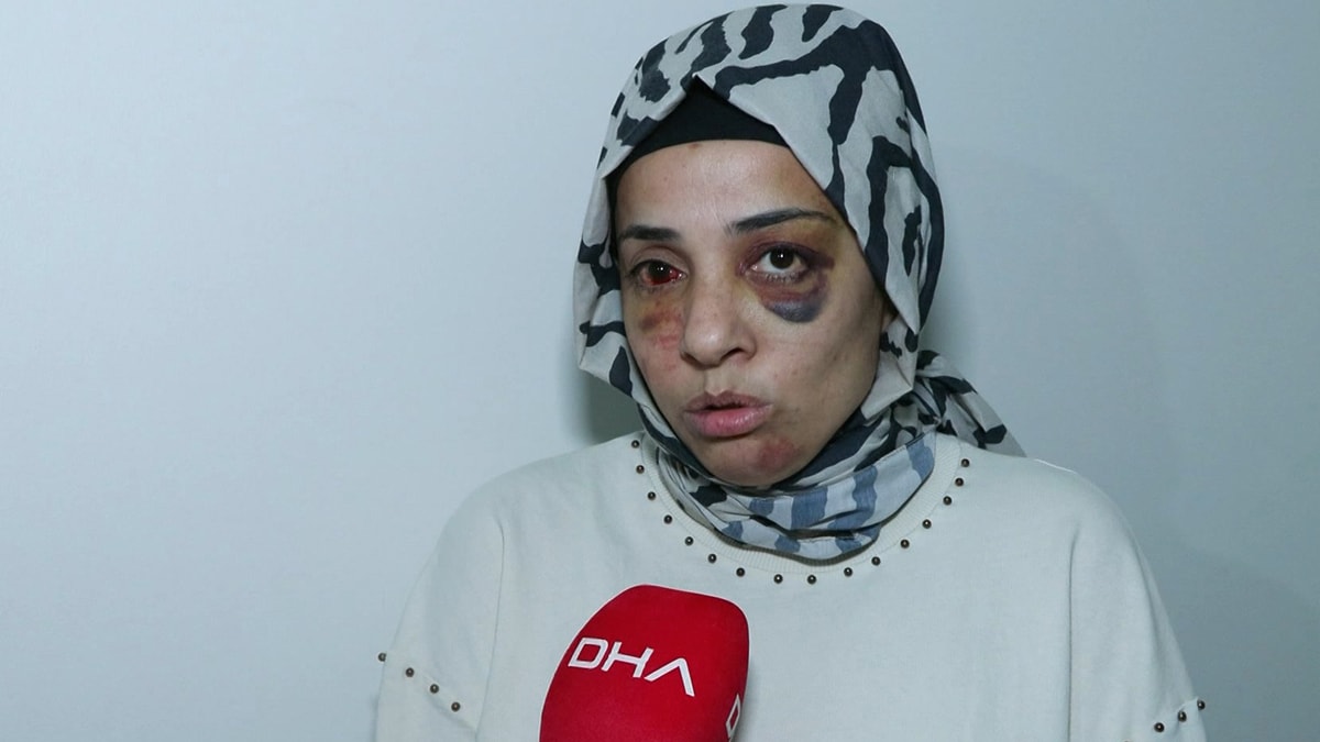 Eski eşinin ailesi sokakta pusu kurdu