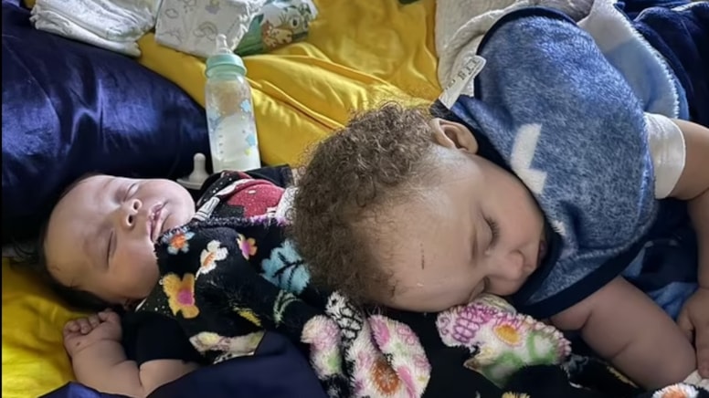Mucize kurtuluş: Kasırgaya kapılan 4 aylık bebek ağaçta bulundu