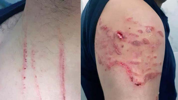 Yanlış evin kapısını kırıp karı-kocanın üzerine köpek salan polise savcı beraat istedi