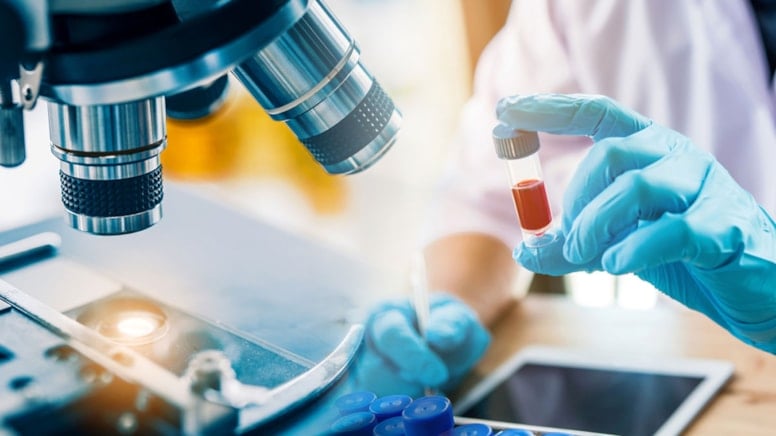 Hızlı yaşlanan organlar bir test ile tespit edilebilecek