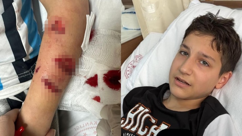 12 yaşındaki çocuk, sevdiği köpeğin saldırısında yaralandı