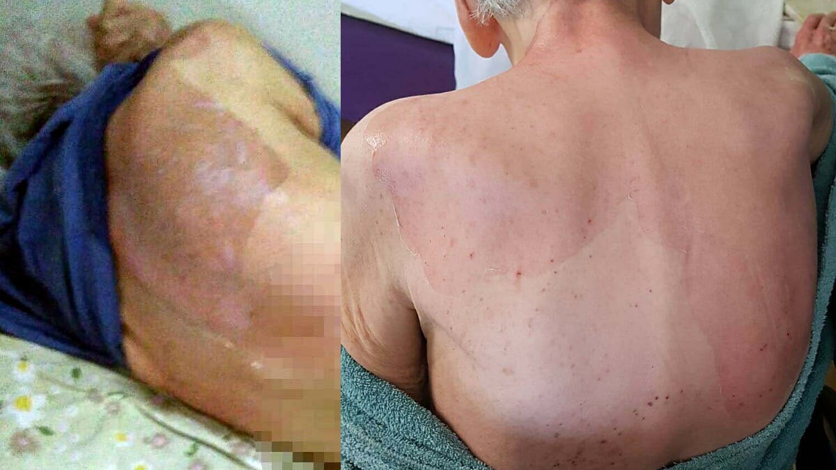 Yaşlı kadını kaynar suyla yıkayan 2 görevliye hapis cezası