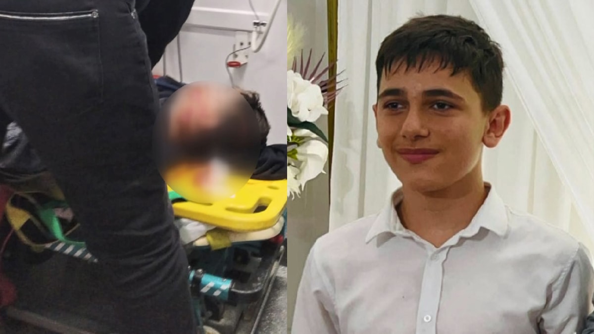 Makineye kafası sıkışan çocuk yaşam savaşı veriyor