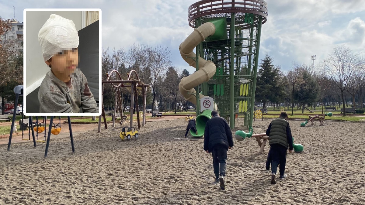 5 yaşındaki çocuğa parkta köpek saldırdı