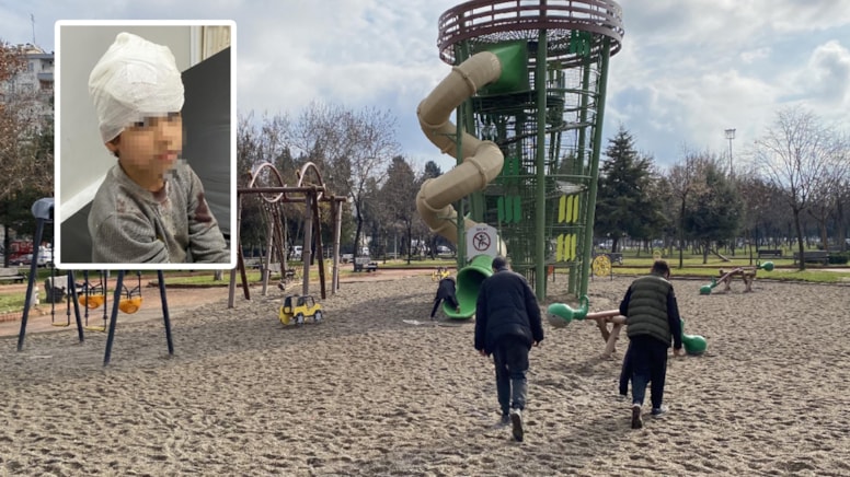 5 yaşındaki çocuğa parkta köpek saldırdı