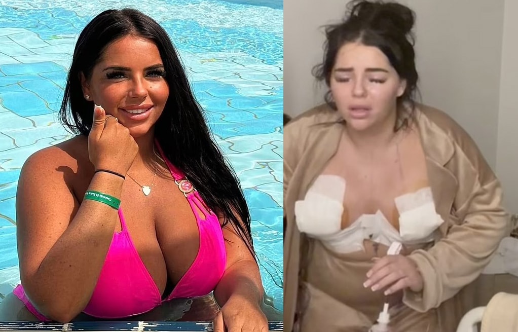 İngiltere ve Türkiye arasındaki estetik krizi büyüyor... Bir vaka daha...