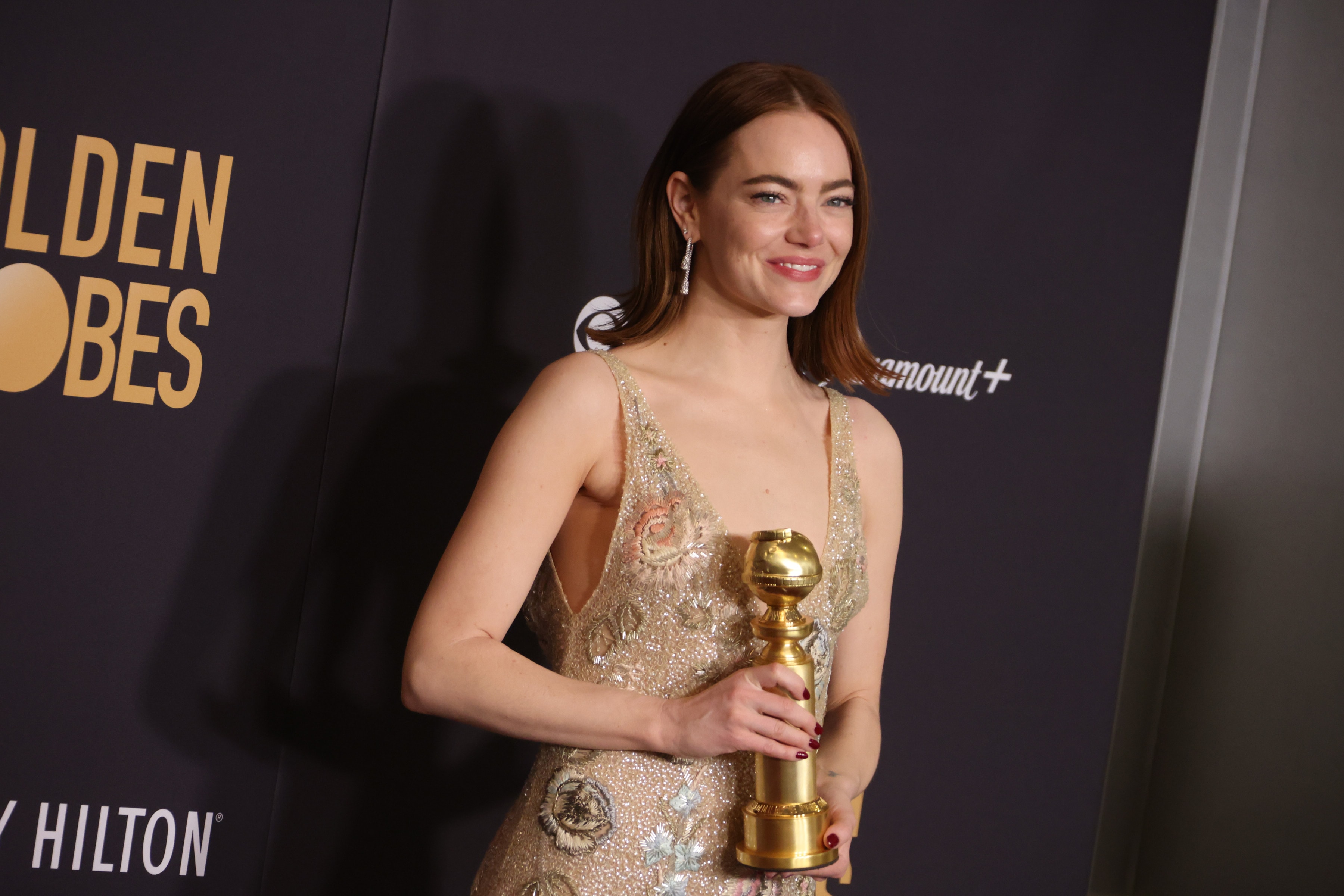 Emma Stone ödüllerinin nerede olduğunu açıkladı