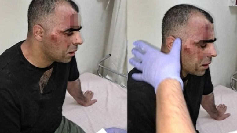 Saldırıya uğrayan gazeteci Sinan Aygül'e hapis cezası