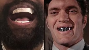 Kanye West titanyum dişleriyle olay oldu... Elmastan daha değerli