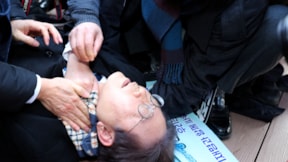 Ana muhalefet partisi lideri bıçaklandı