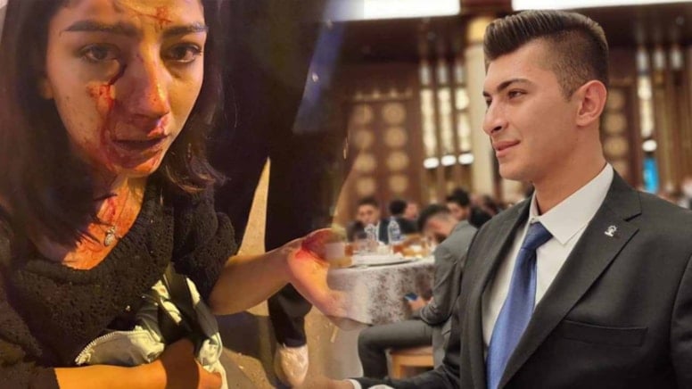 AKP Gençlik Kolları Başkanı konserde genç kızı hastanelik etti