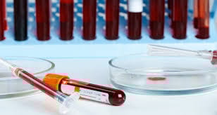 Bilim insanları açıkladı: Felç riski en yüksek olan kan grubu belli oldu