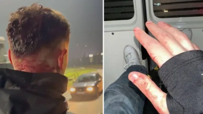 Saraybosna'da Trabzonlu taraftarlara saldırı