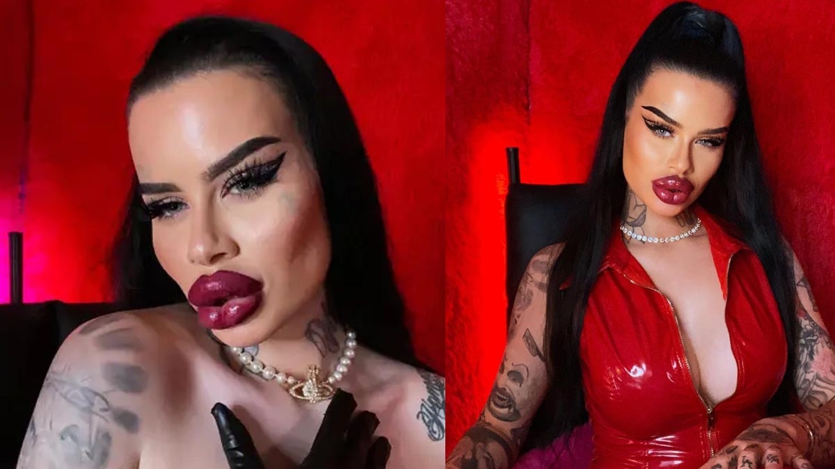 Estetik bağımlısı kadın 2 milyon TL verip yüzünü bu hale getirdi