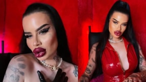 Estetik bağımlısı kadın 2 milyon TL verip yüzünü bu hale getirdi