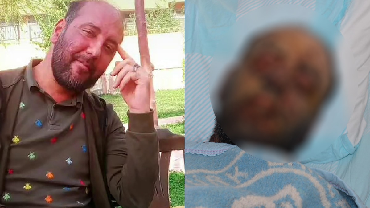 Yağmur ormanlarındaki hastalık Erzurum'da: Tanınmaz hale geldi...