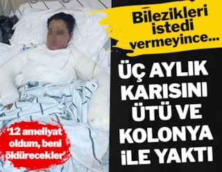 Kocasının ütüyle yaktığı Yazgül'den çığlık: Beni öldürecekler