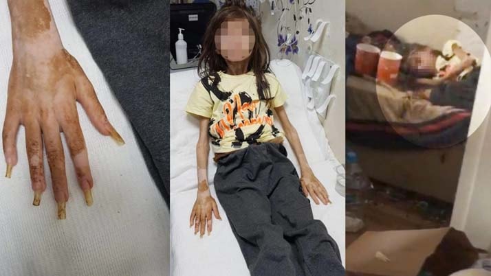 Yeğenini çöp evde alıkoymuştu... Vicdansız teyze için karar