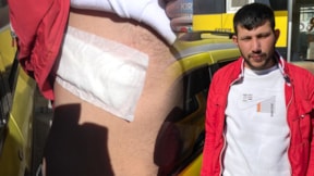 Konya'da taksi şoförü müşterisi tarafından bıçaklandı