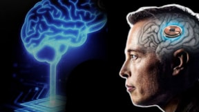 Neuralink'in asıl amacı ne? Elon Musk ne planlıyor?