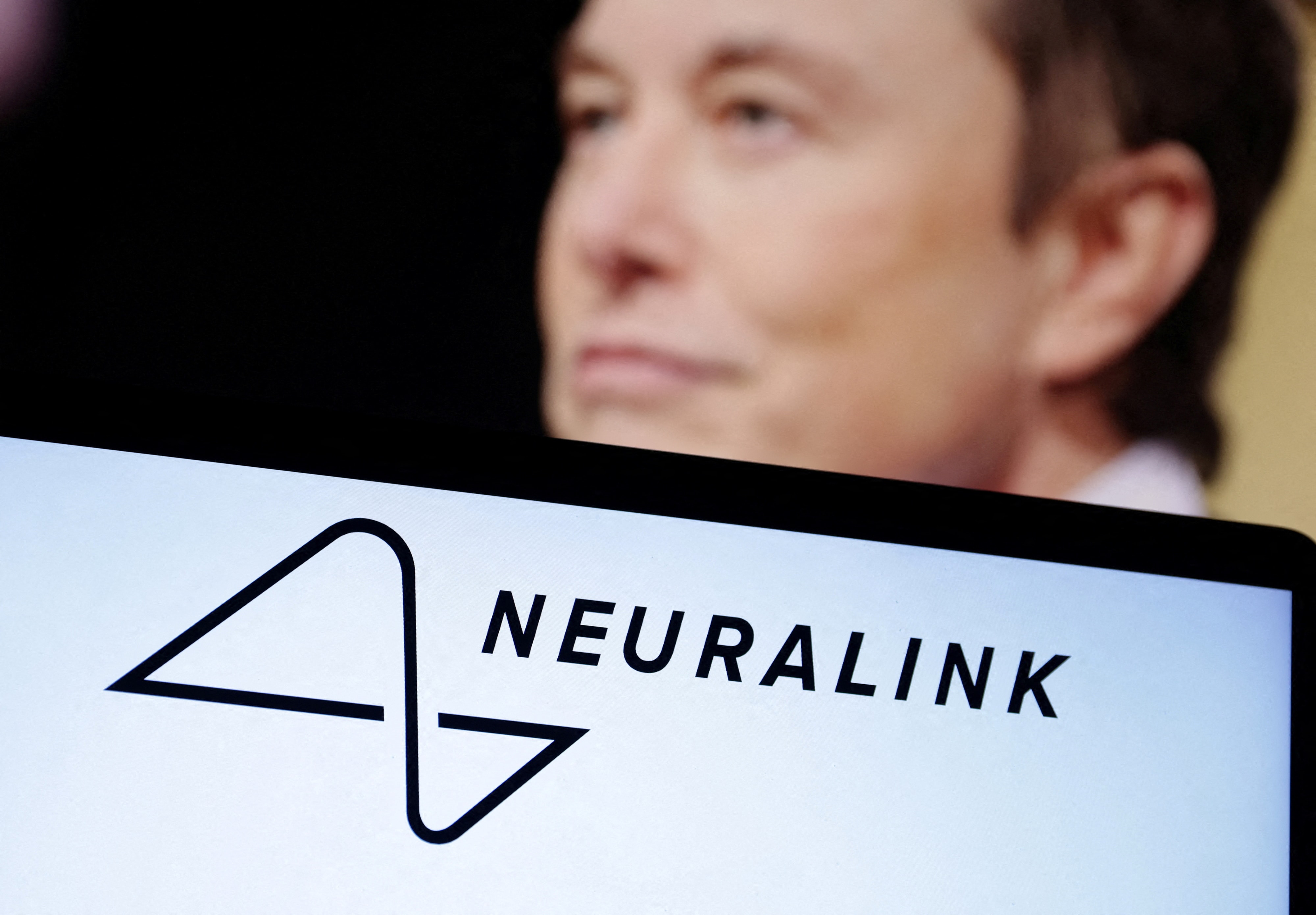 Evliliğini kurtarmak için beynine Neuralink'in çipinin takılmasını istiyor