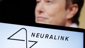 Musk'ın beyin çipi ölüm mü saçıyor? Ünlü uzman uyardı