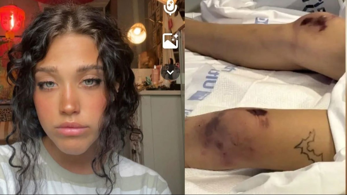 23 dakika boyunca nefes almadı: Yurt odasında ne oldu?