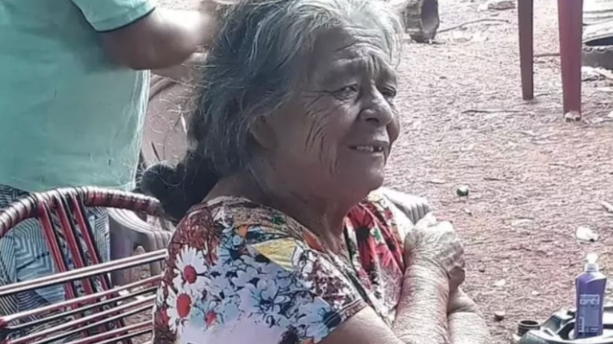 Doktorlar şaştı: 81 yaşında hamile kadın 56 yıl "taş bebek"le yaşamış