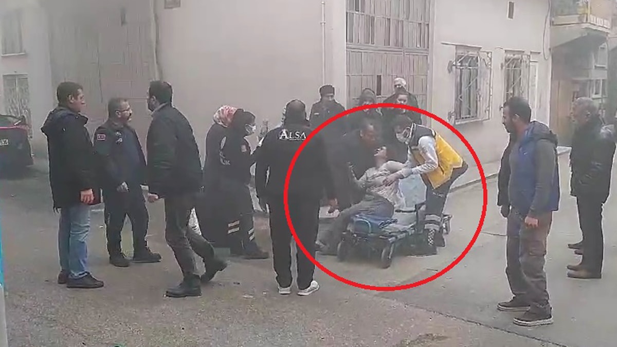 Evinde çıkan yangına müdahale ederken yaralandı