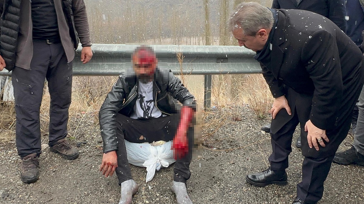 Destici, kan revan içindeki yaralı şoförle sohbet etti