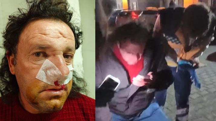 İstanbul'da 'site yönetimi' kavgası