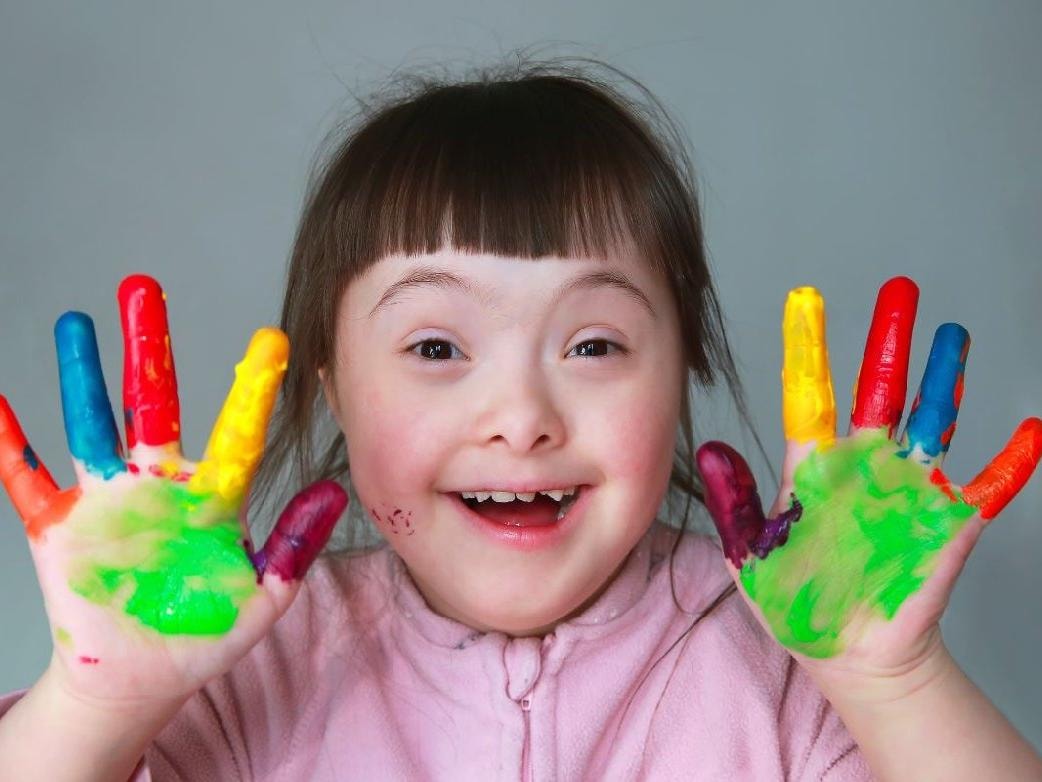 21 Mart Dünya Down Sendromu Farkındalık Günü: Down Sendromu nedir, neler yapabiliriz?