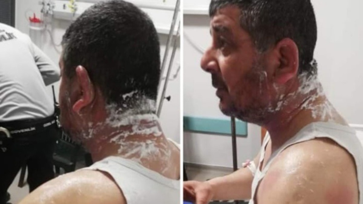 Tartıştığı kiracısına asitle saldırdı