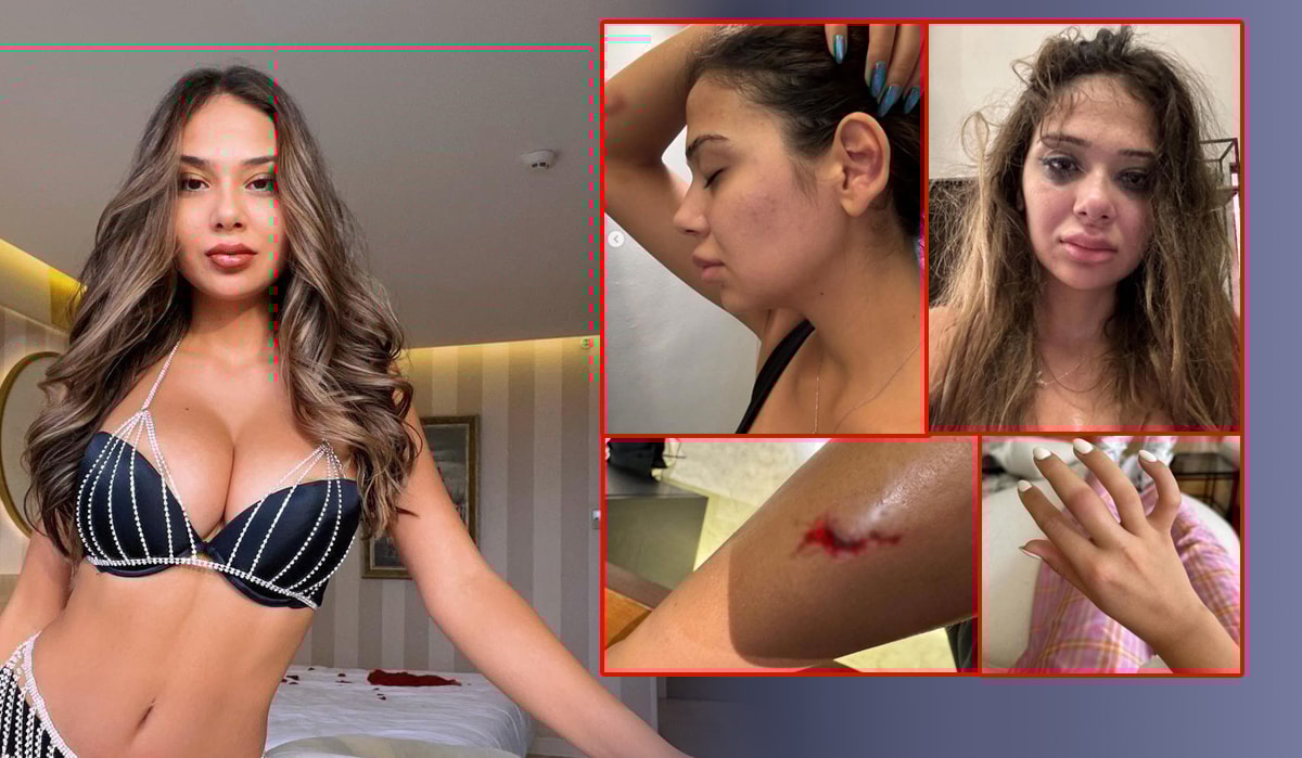 Merve Taşkın yaşadığı kabusu paylaştı