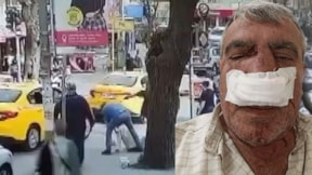 İstanbul'da taksici dehşeti: Burnunu kırdı