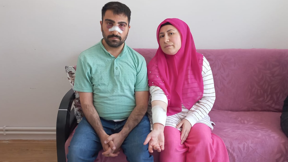 Komşu dehşeti: Engelli adamın önce burnunu kırdı sonra sıcak suyla haşladı