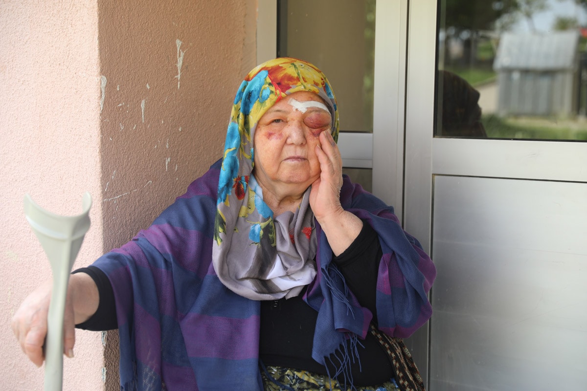 Sahipsiz köpeklerden kaçan yaşlı kadın tanınmaz halde...