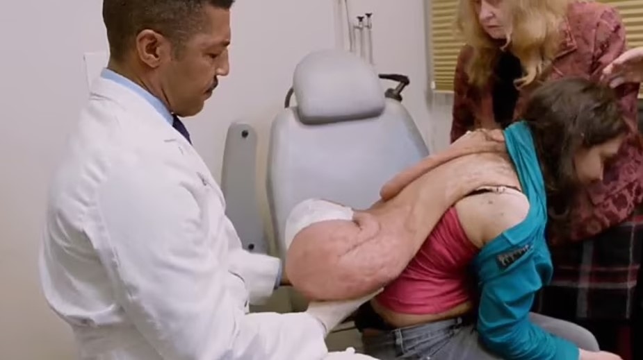 3 bin kişiden birinde görülüyor... 20 kiloluk tümörle yaşıyordu