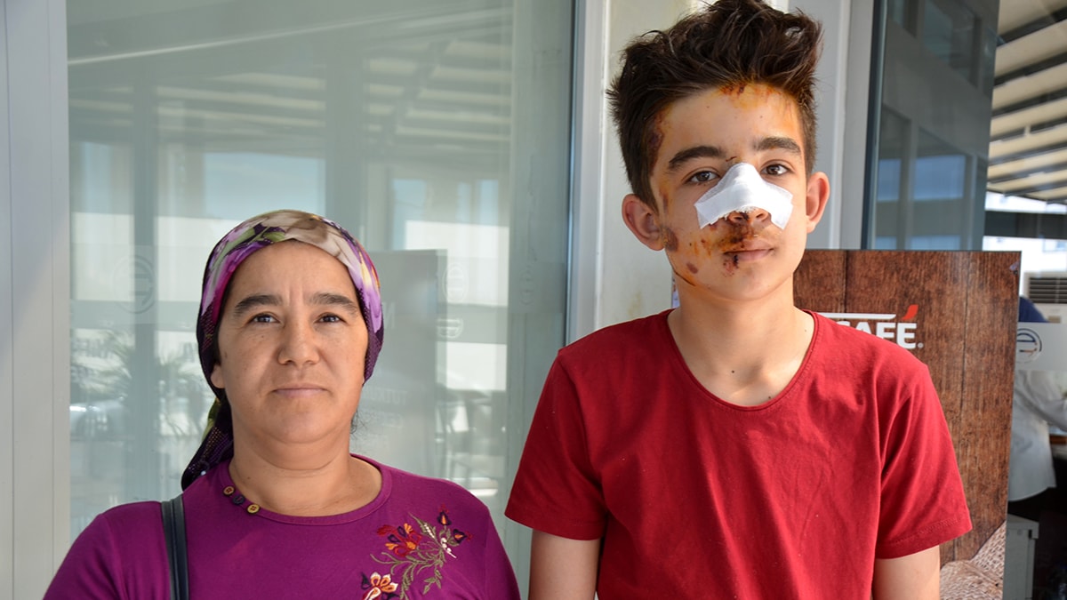 Köpeklerden kaçarken otomobil çarptı