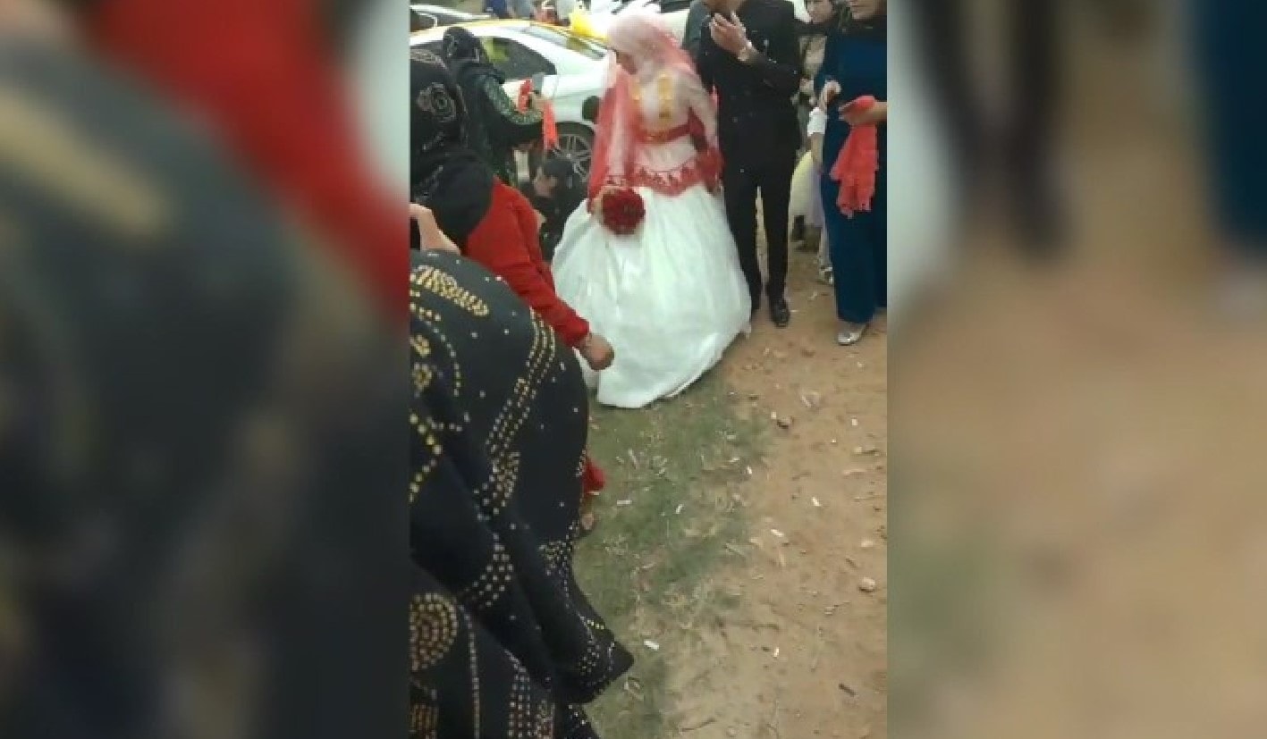 Düğünde vurulan hamile kadın bebeğini kaybetti