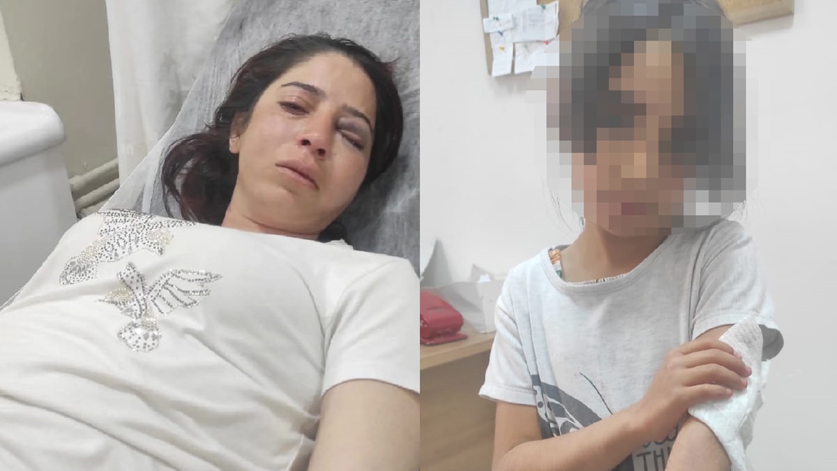 Şiddet sebebiyle kocasından kaçtı, sığındığı erkek kardeşi sopayla dövdü