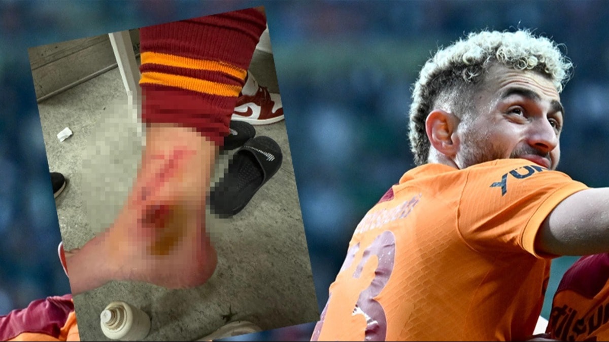 Galatasaray'dan Barış Alper Yılmaz tepkisi: "Bileği bu hale geldi"