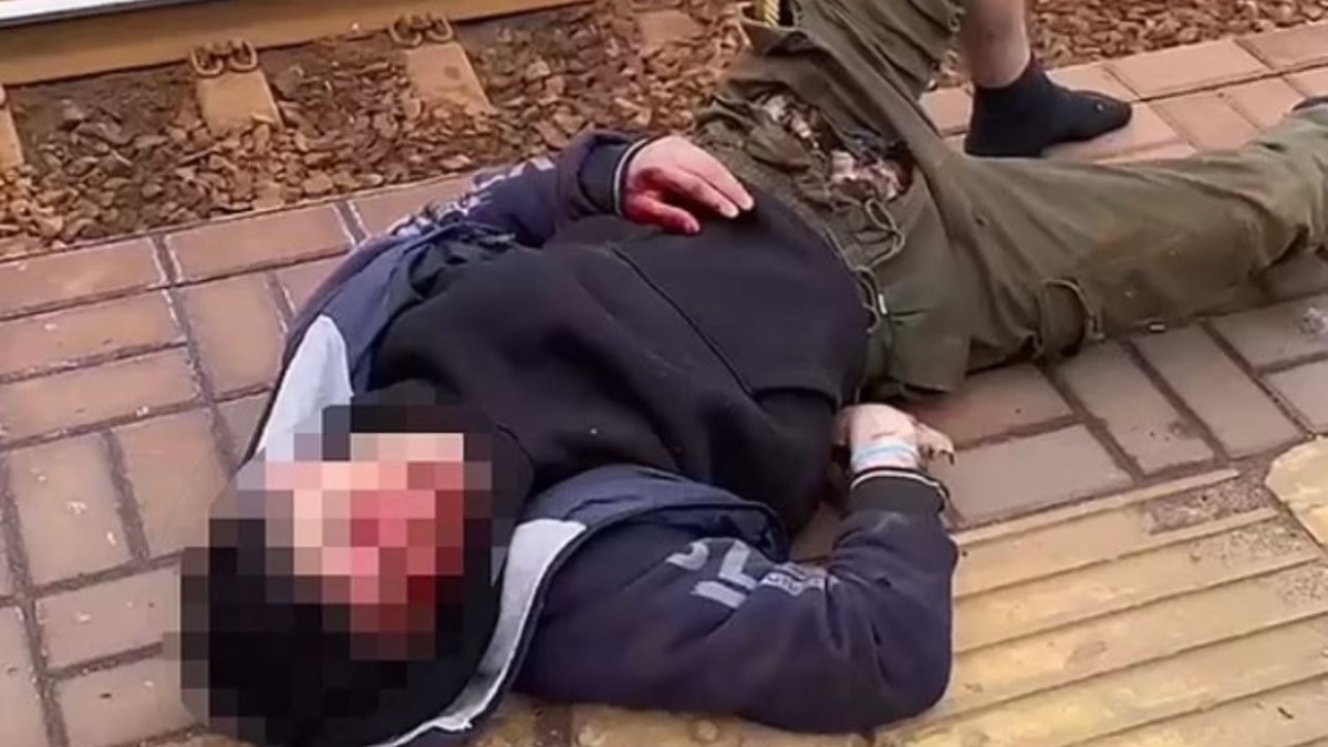 15 yaşındaki çocuk TikTok videosu çekerken ölümden döndü: Penisi yandı