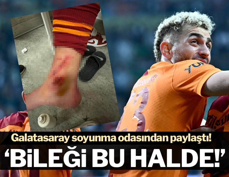 Galatasaray'dan Barış Alper Yılmaz tepkisi: "Bileği bu hale geldi"