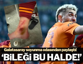 Galatasaray'dan Barış Alper tepkisi: "Bileği bu halde"