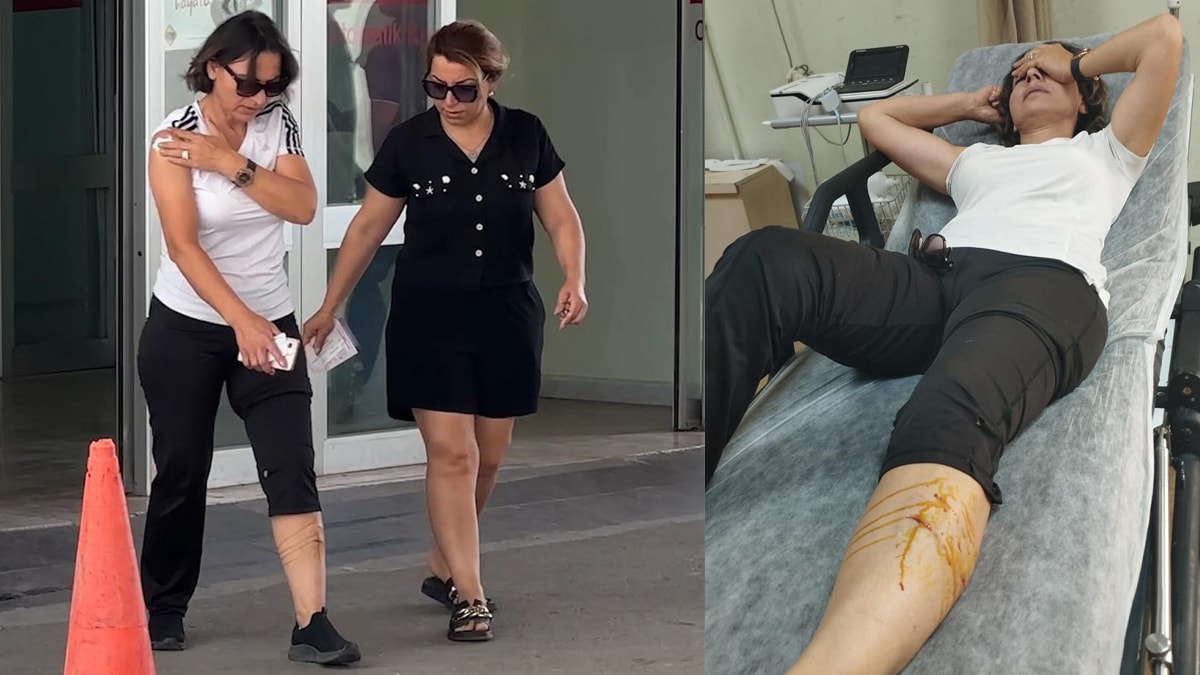 Spor yaparken başıboş köpeklerin saldırısına uğradı